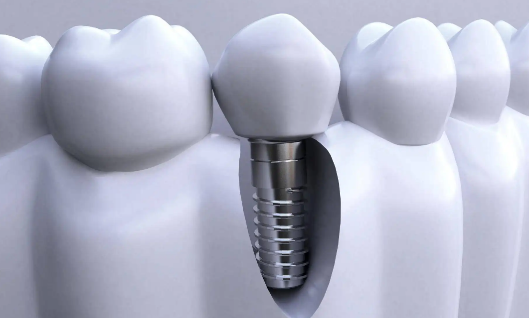 1669173572229912.png QQ截圖20221123111916.png