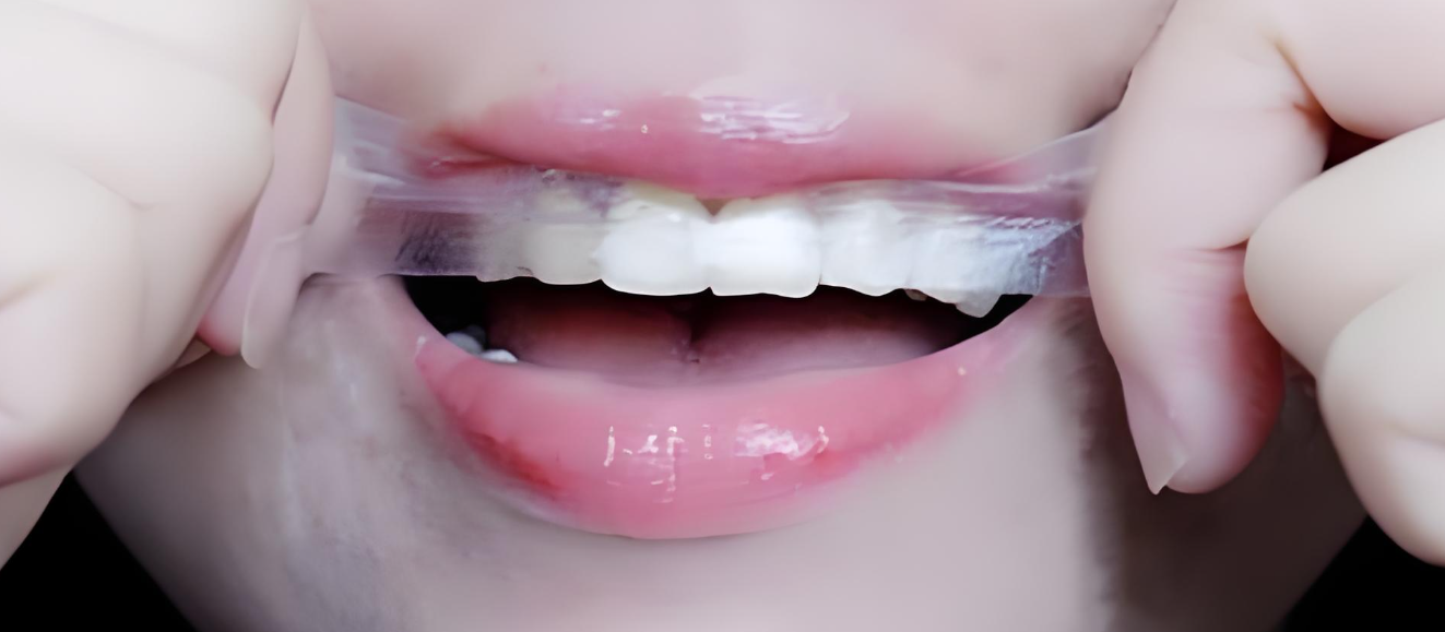 牙齒不白，有什么有效的白牙手段